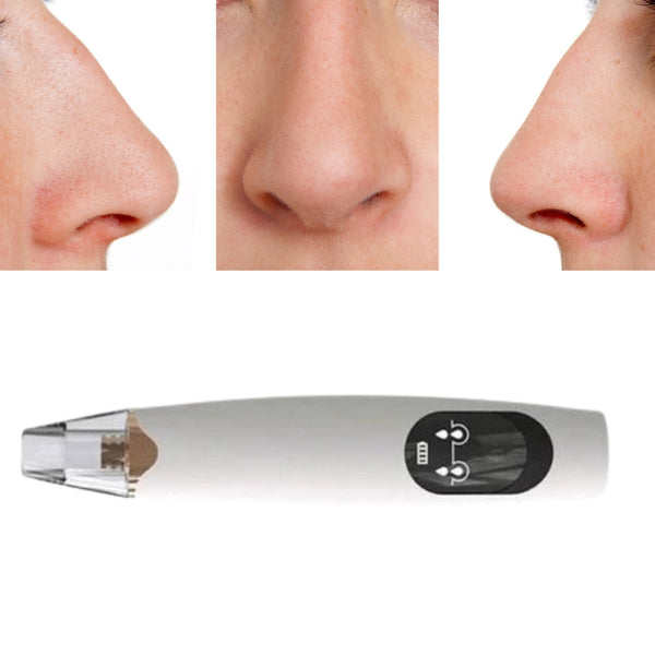 Electric Blackhead Remover Vacuum Pore Cleaner